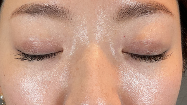 手术后的状态 其一