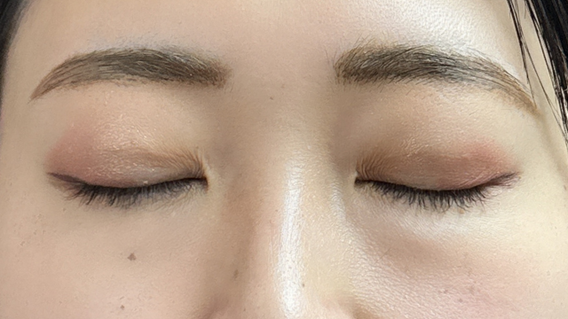 手术后的状态 其一