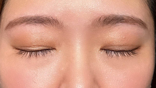 手术后的状态 其一