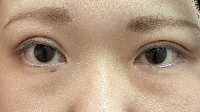 Postoperative Condition Part 1