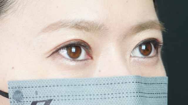 手术后的状态 其一