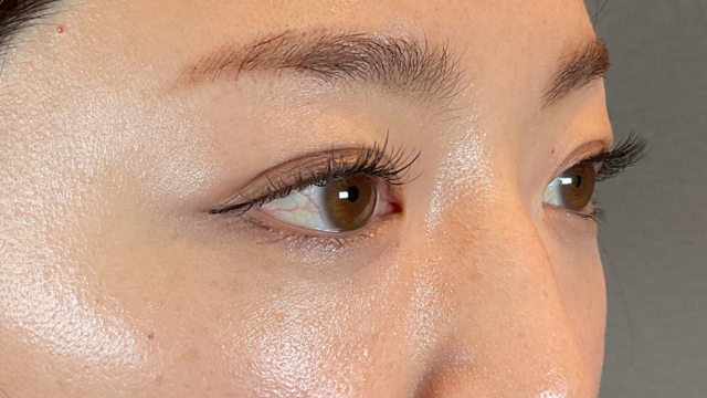 手术后的状态 其一