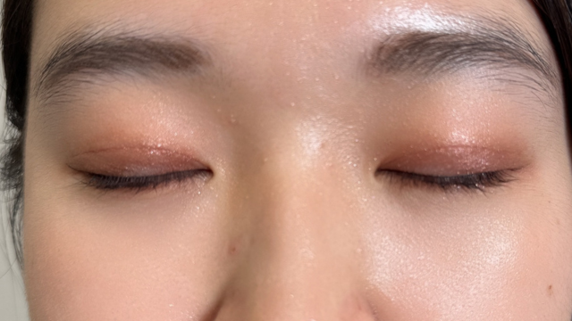 手术后的状态 其一