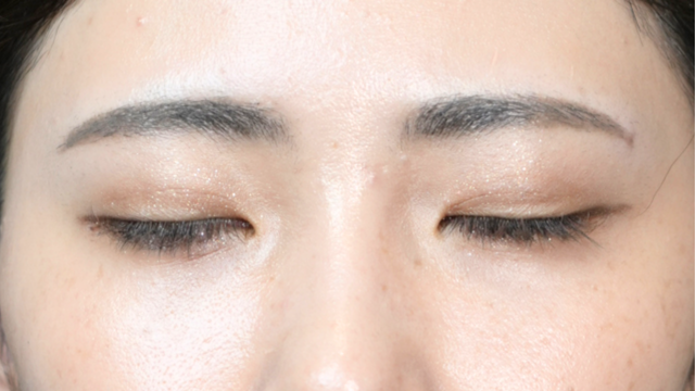 Postoperative Condition Part 1