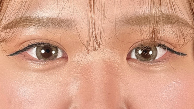 手术后的状态 其一