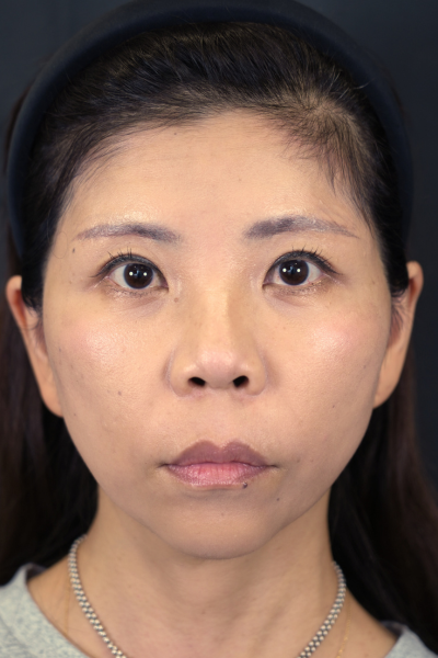 Postoperative Condition Part 1