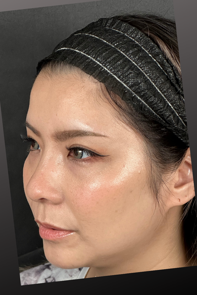 手术后的状态 其一