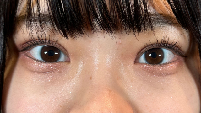 手术后的状态 其一