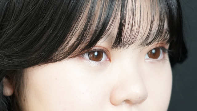 手术后的状态 其一