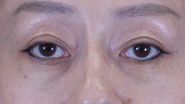 Postoperative Condition Part 1