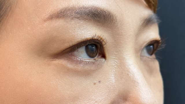 Postoperative Condition Part 1