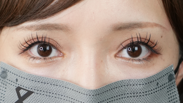 Postoperative Condition Part 1