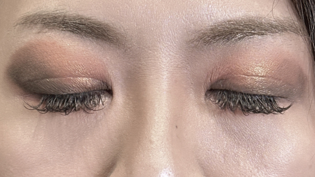 Postoperative Condition Part 1