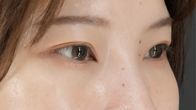 Postoperative Condition Part 1