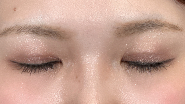 手术后的状态 其一