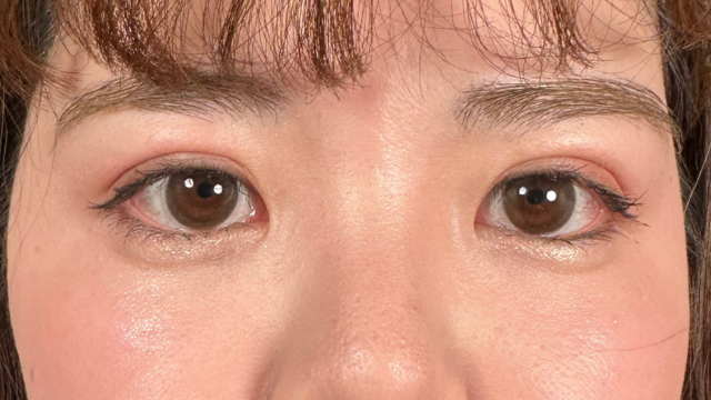 手术后的状态 其一