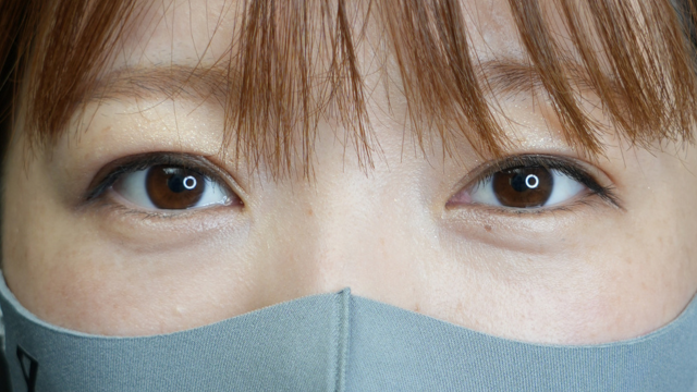 手术后的状态 其一