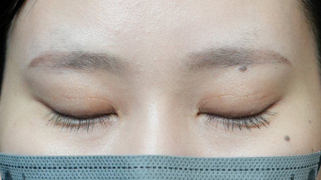 Postoperative Condition Part 1