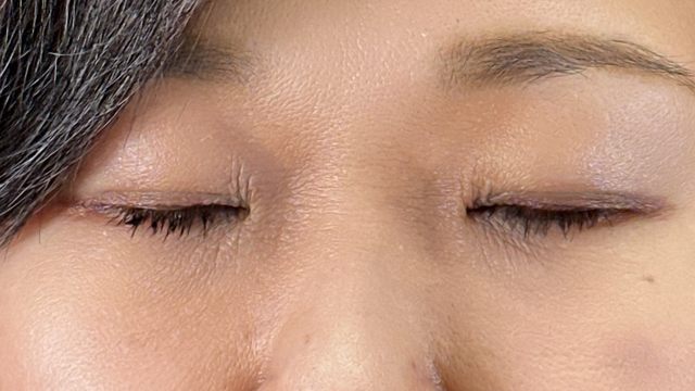 Postoperative Condition Part 1