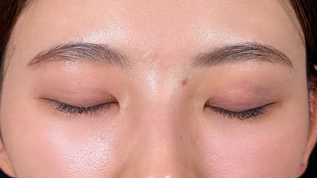 手术后的状态 其一