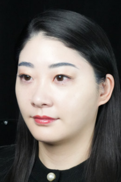 手术后的状态 其一