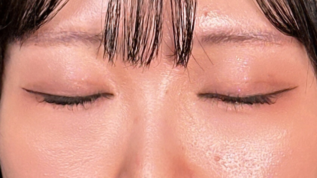 手术后的状态 其一