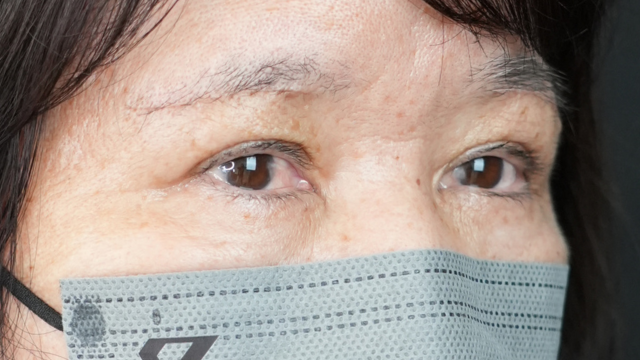 手术后的状态 其一