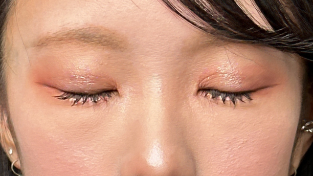 手术后的状态 其一