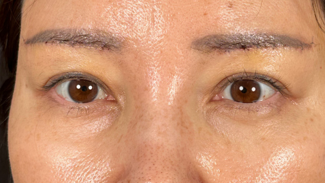 Postoperative Condition Part 1