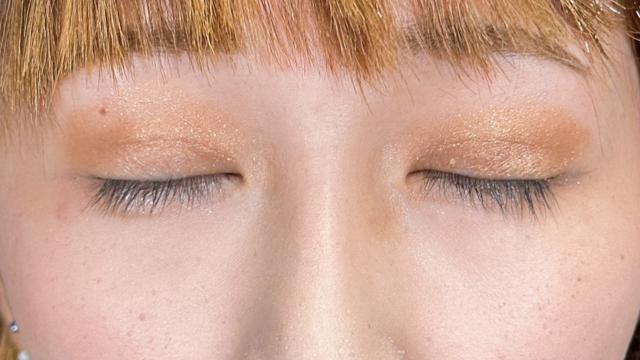 手术后的状态 其一