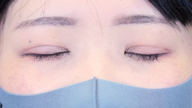 Postoperative Condition Part 1