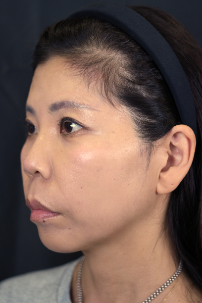 Postoperative Condition Part 1