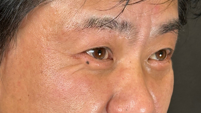 Postoperative Condition Part 1