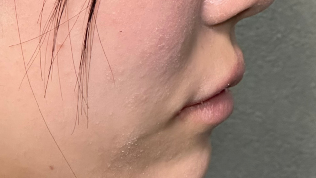 Postoperative Condition Part 1