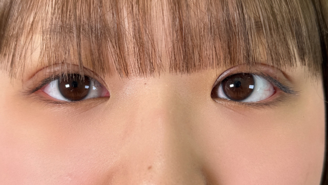 Postoperative Condition Part 1