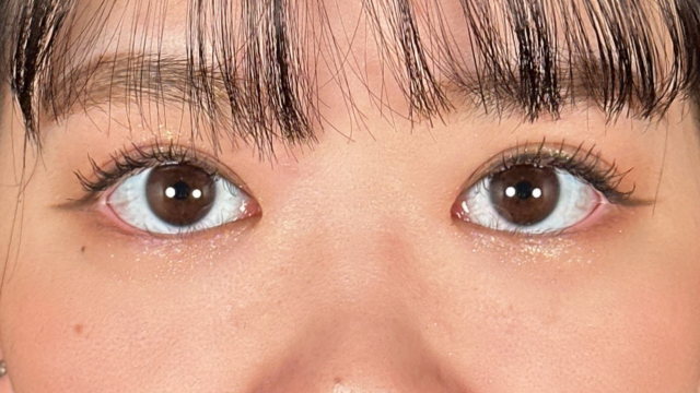 手术后的状态 其一