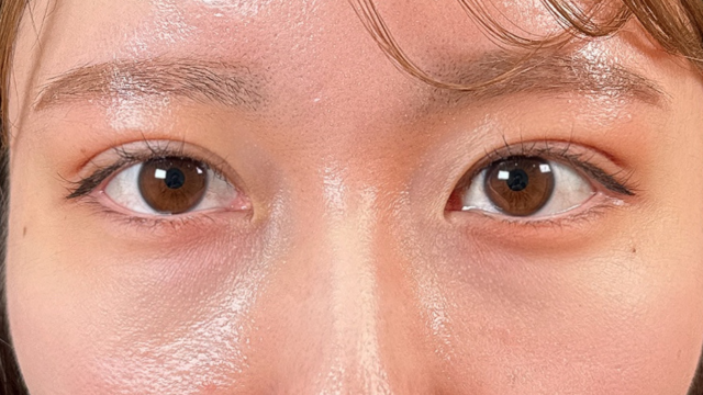 手术后的状态 其一