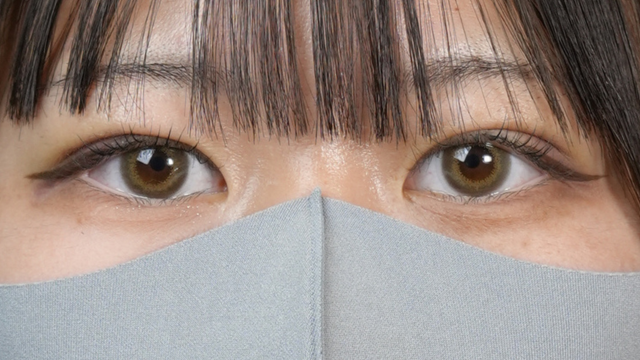 手术后的状态 其一