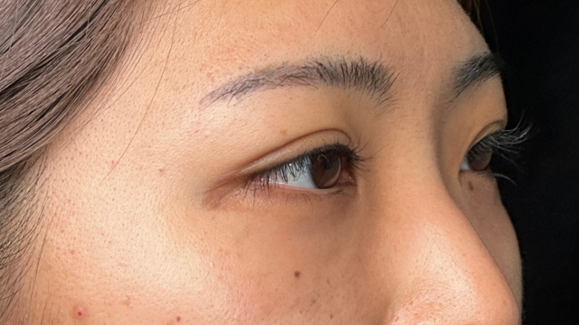 Postoperative Condition Part 1