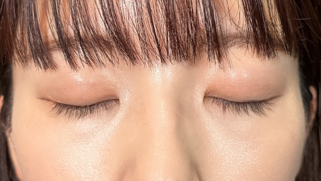 手术后的状态 其一