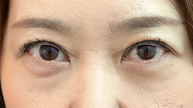 Postoperative Condition Part 1