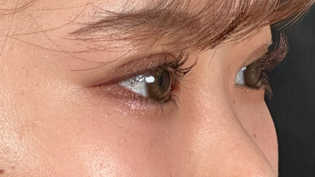 手术后的状态 其一