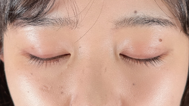 手术后的状态 其一