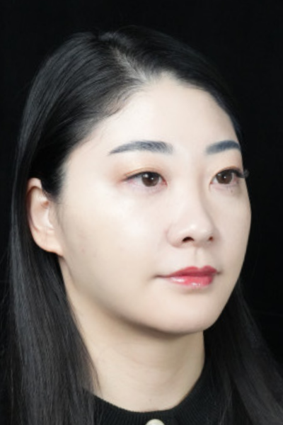 手术后的状态 其一