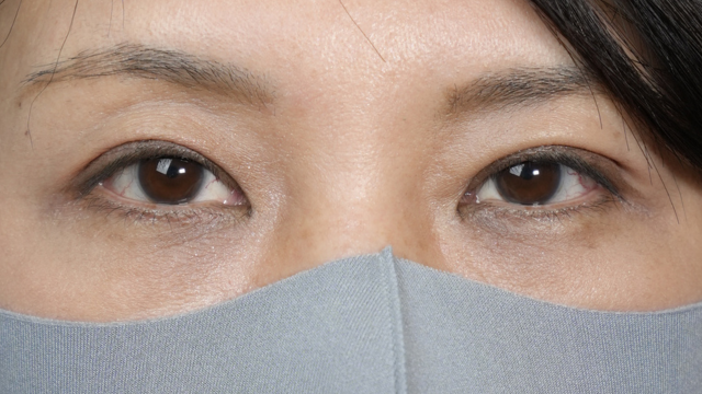 Postoperative Condition Part 1