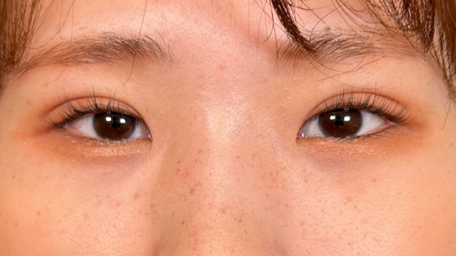 手术后的状态 其一