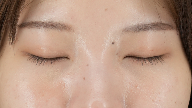 Postoperative Condition Part 1