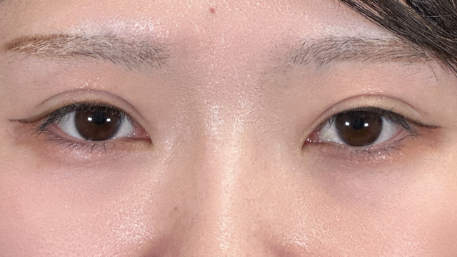 手术后的状态 其一