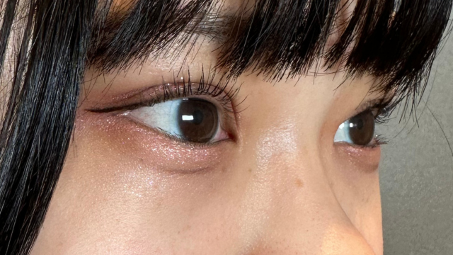 手术后的状态 其一