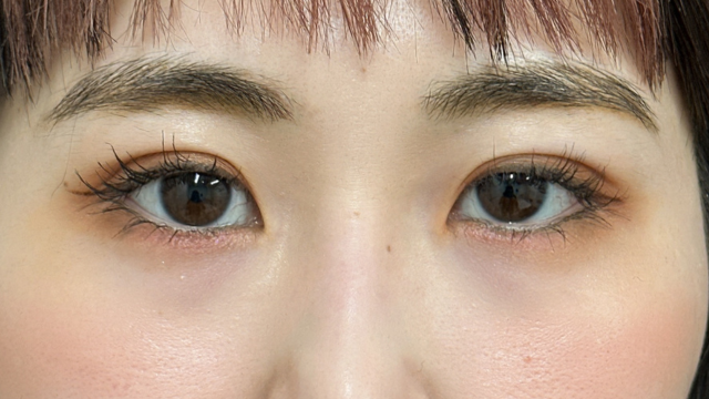 手术后的状态 其一